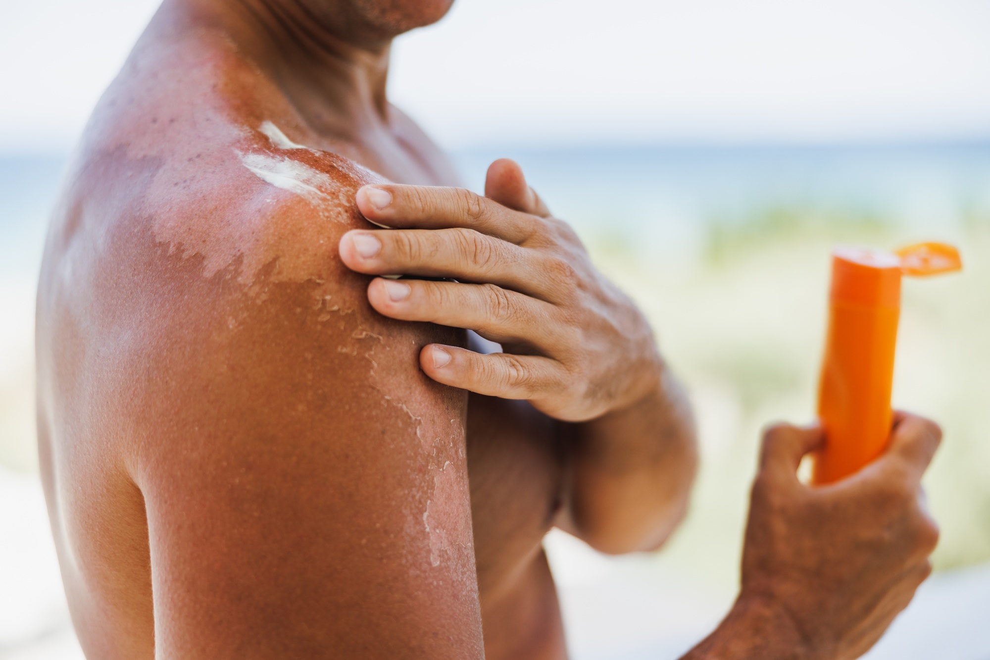 Applying Suntan Lotion